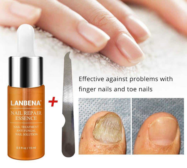 Nail Repair Treatment Essence - wnkrs