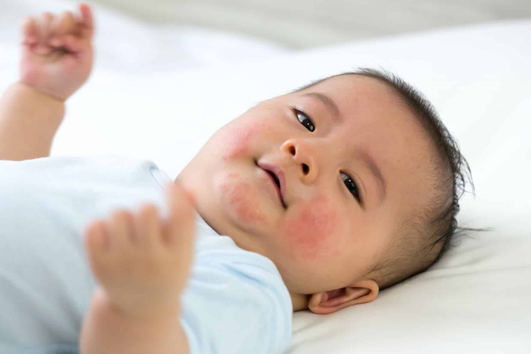 How to keep your little ones’ skin soft and safe?