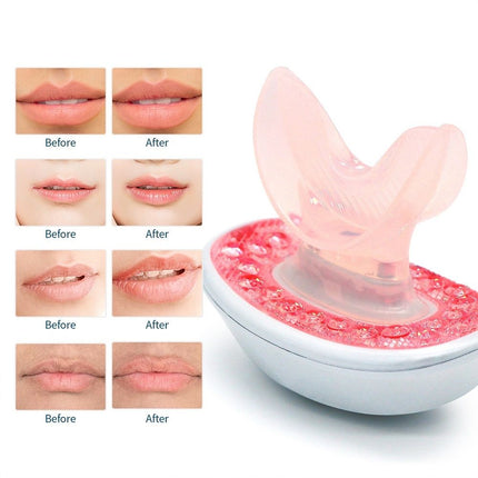 Rechargeable LED Lip Plumper Device: Restore & Enhance Natural Beauty - Wnkrs