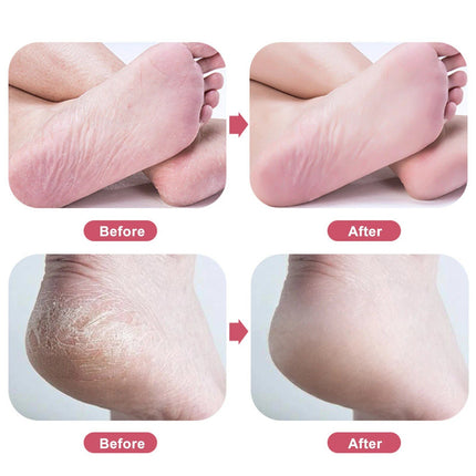 Nano Glass Foot Rasp: Quick & Gentle Callus Remover - Wnkrs