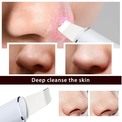 Ultrasonic Skin Scrubber - Wnkrs