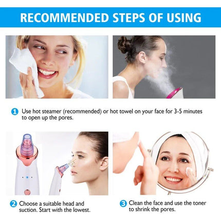 Electric Facial Vacuum Blackhead & Acne Remover with Deep Pore Cleansing - Wnkrs