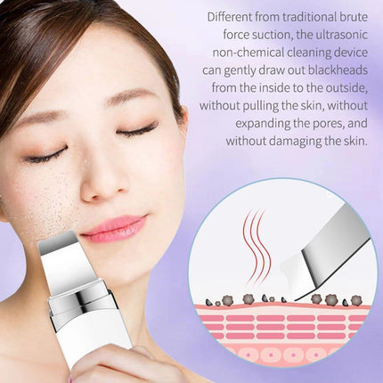 Ultrasonic Facial Scrubber: Deep Cleansing & Rejuvenation Spatula - Wnkrs