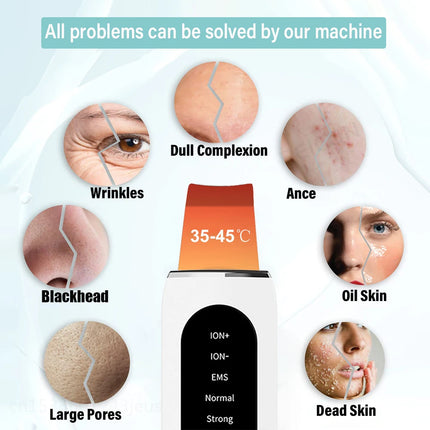 Ultrasonic Skin Scrubber: Deep Pore Cleanser & Blackhead Remover