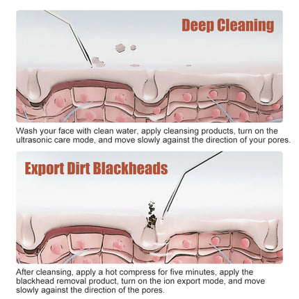 Depurador ultrasónico de piel y eliminador de puntos negros