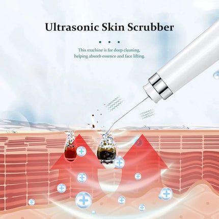 Ultrasonic Skin Scrubber - Wnkrs